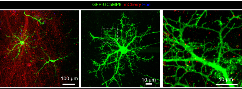 科学家利用 3D打印脑组织结构以推进神经学研究