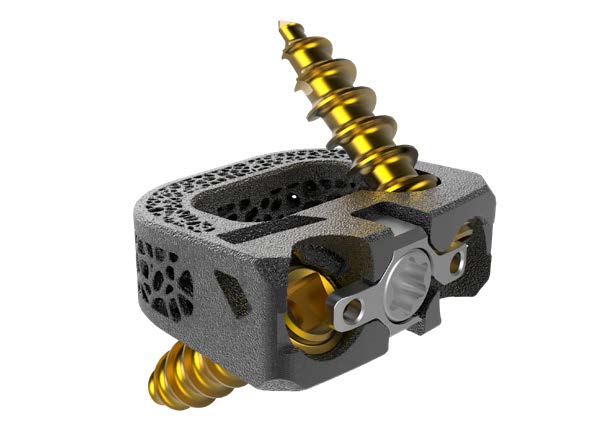 Innosys的UniSpace颈椎融合器获得FDA批准