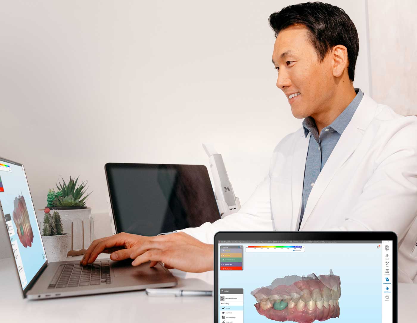 医疗技术公司Align Technology 推出 iTero 设计套件