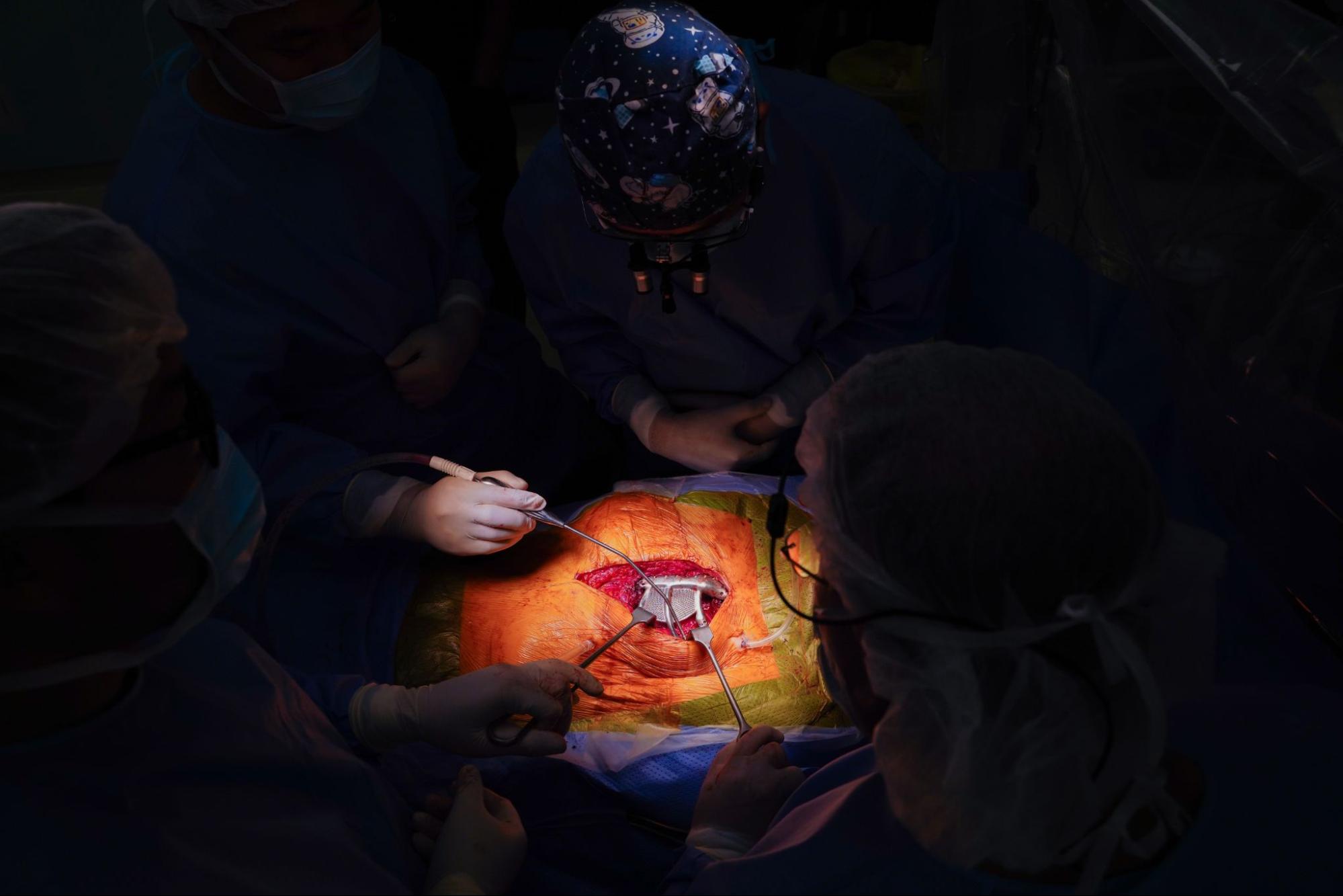 Vinmec 完成东南亚首例3D打印钛植入物胸壁重建手术