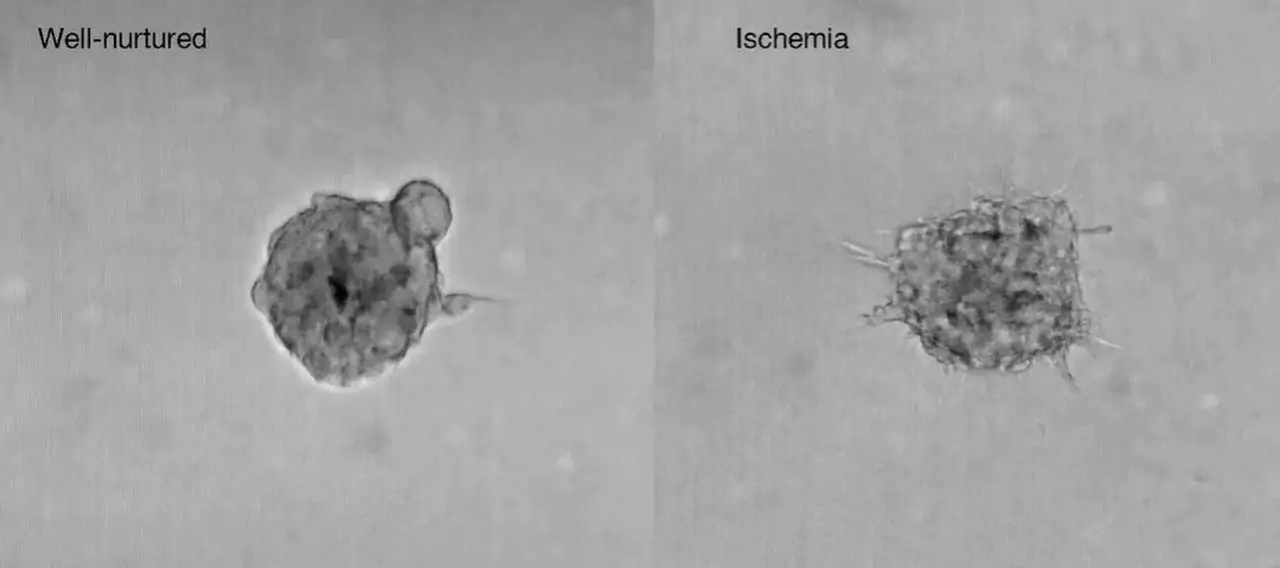 纽约大学研究人员开发新的3D打印模型来研究癌症转移