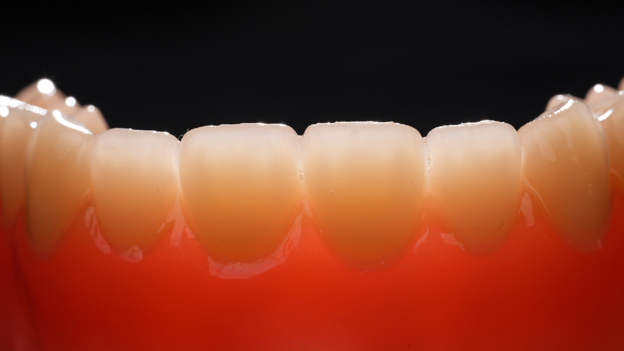 HeyGears推出多材料融合树脂3D打印假牙