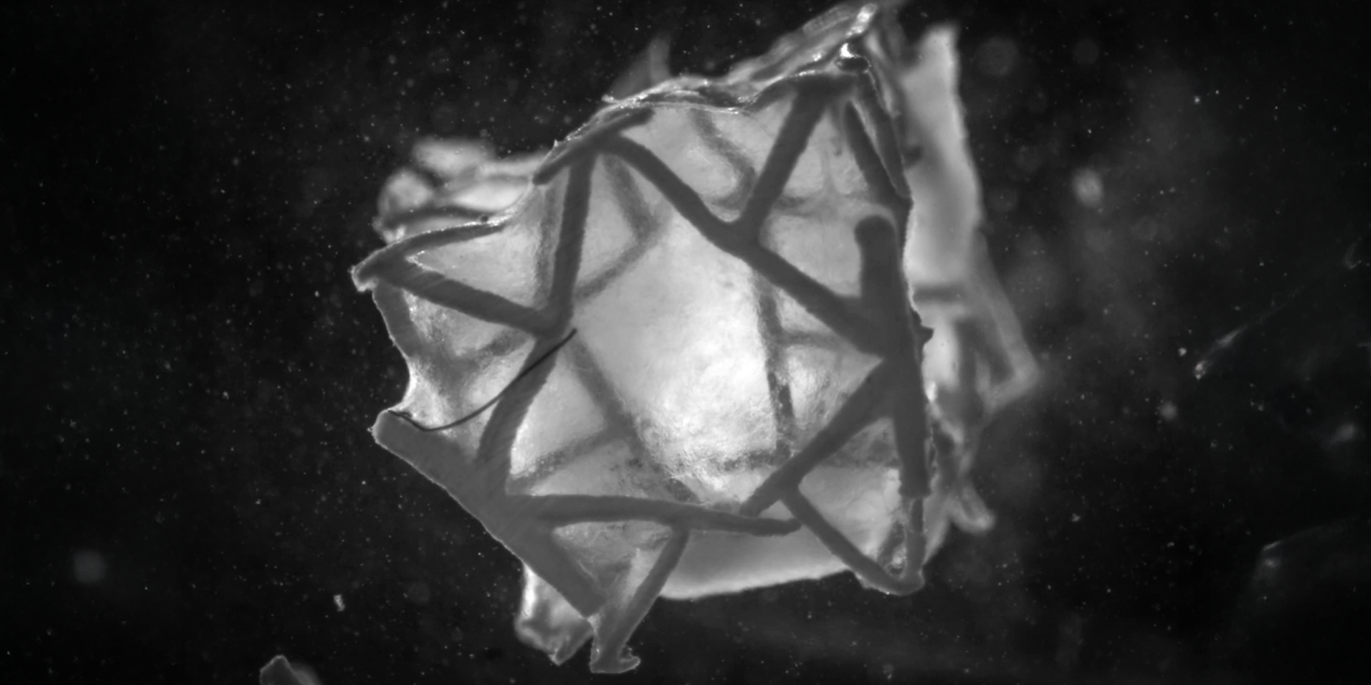 苏黎世联邦理工学院开发出可与心脏组织整合的3D打印心脏贴片