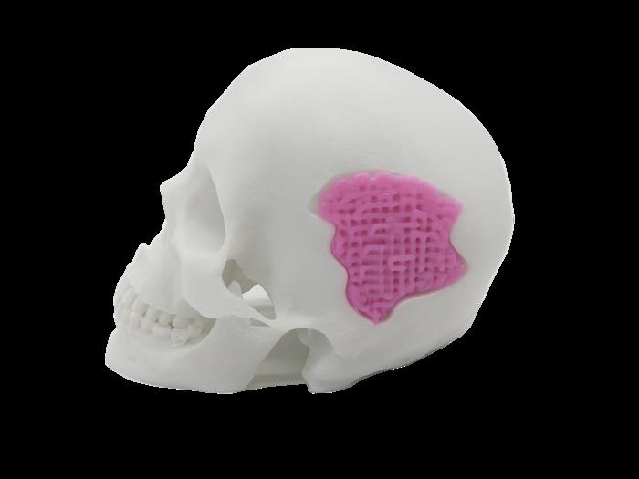 研究人员开发出可用于骨替代应用的3D打印生物玻璃