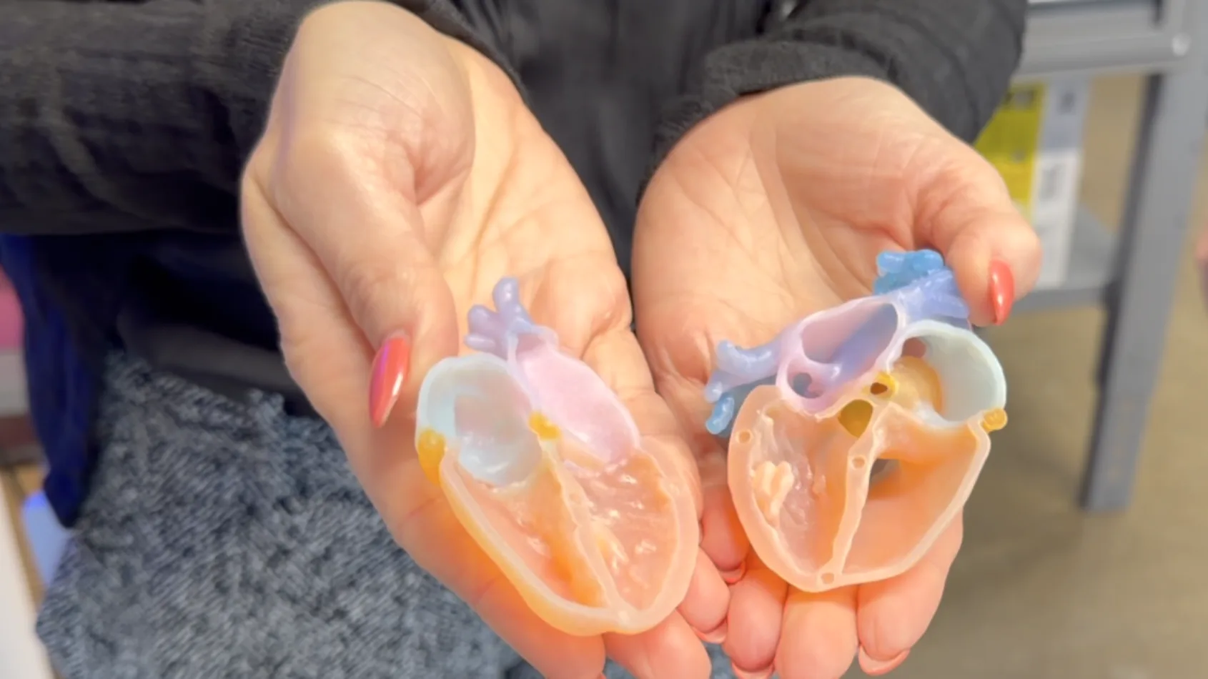 印第安纳大学健康中心开设3D打印工作室 将模型制作周期缩短至24小时